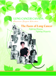 Faces of Lung Cancer Report